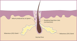 Healthy Pore Healthy Pore
